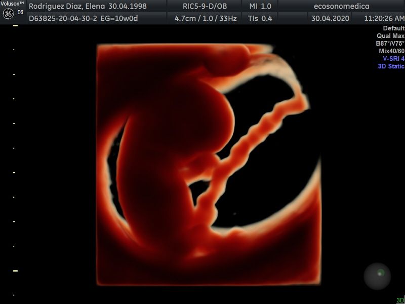 Héctor Bernardo Acevedo Manrique-7