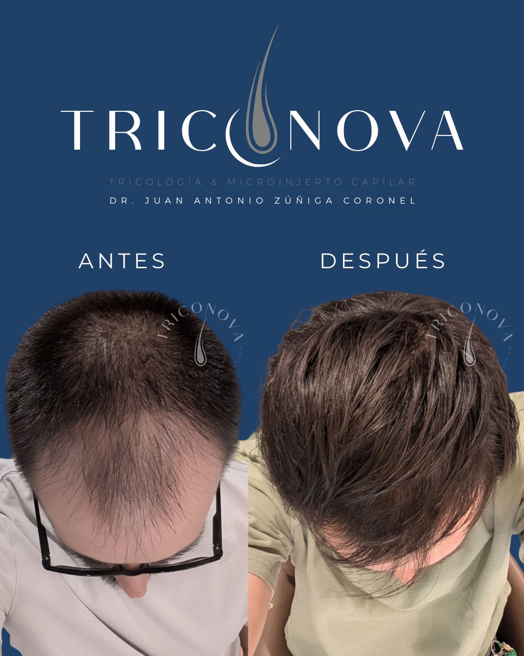 Juan Antonio Zuñiga Coronel-1