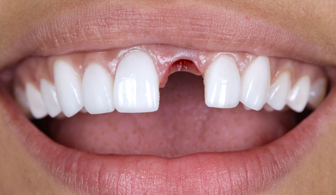 Guillermo Velázquez Gracia-3