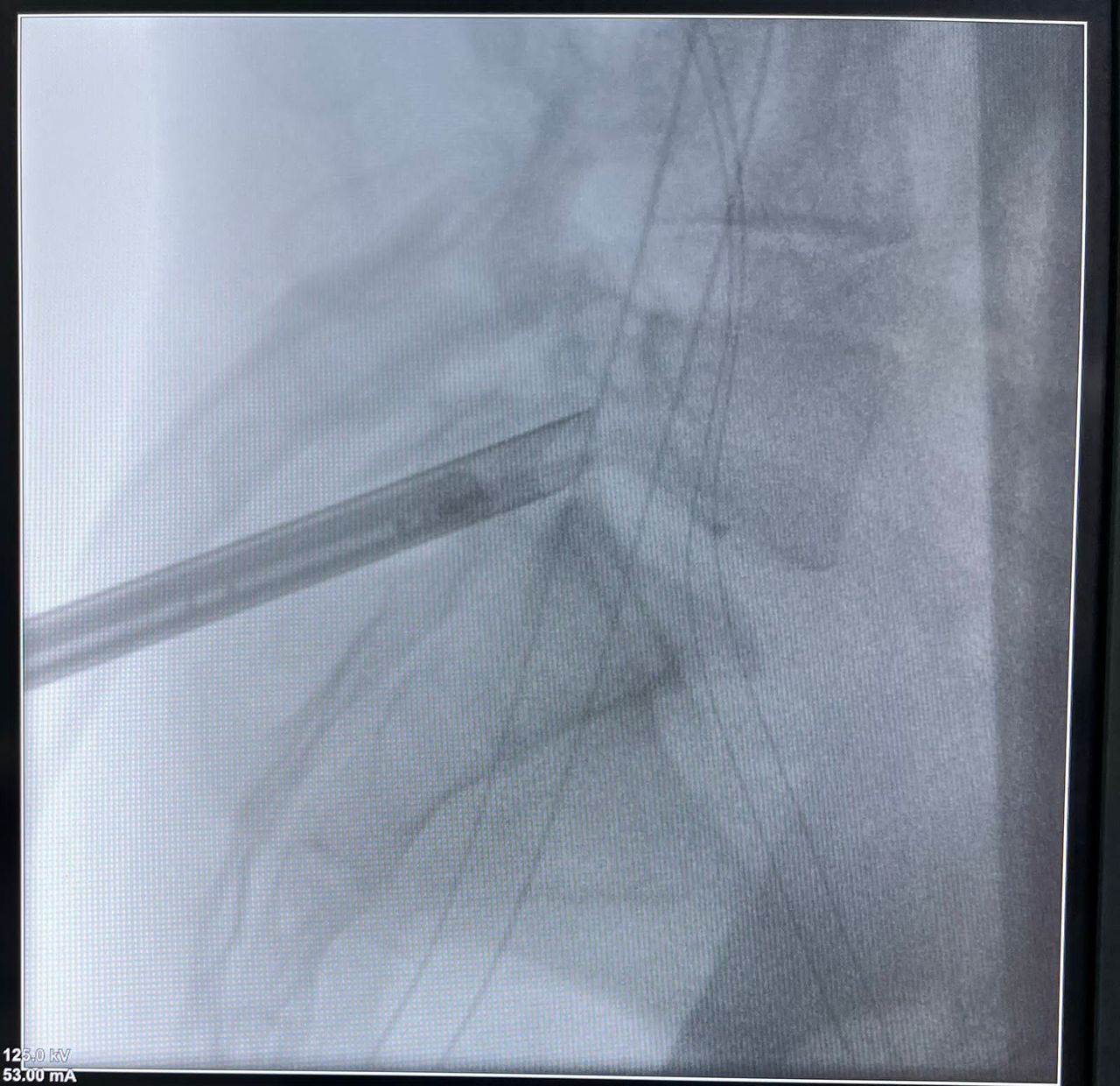 José Luis Sánchez Arellano-17