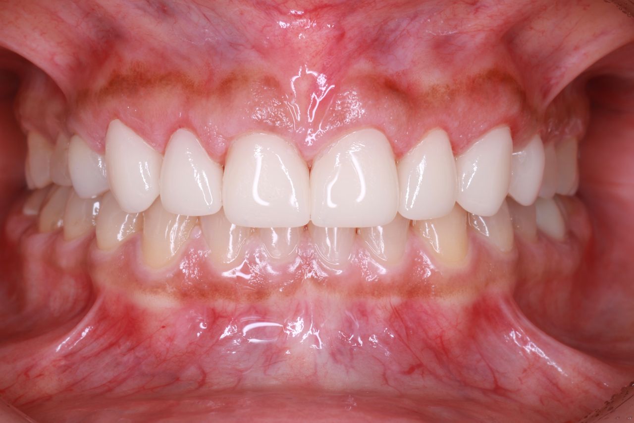 Nallely Alejandra Jiménez Gutiérrez-1