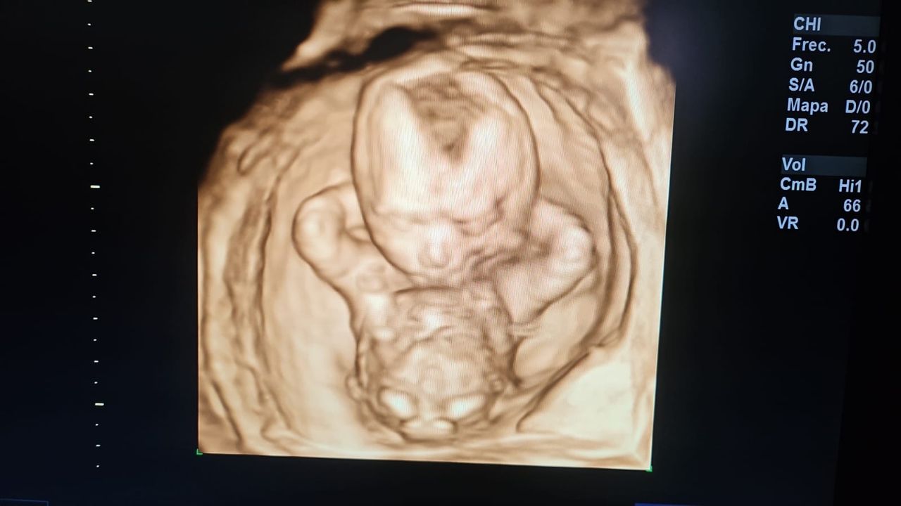 María Teresa Flores Molina-11