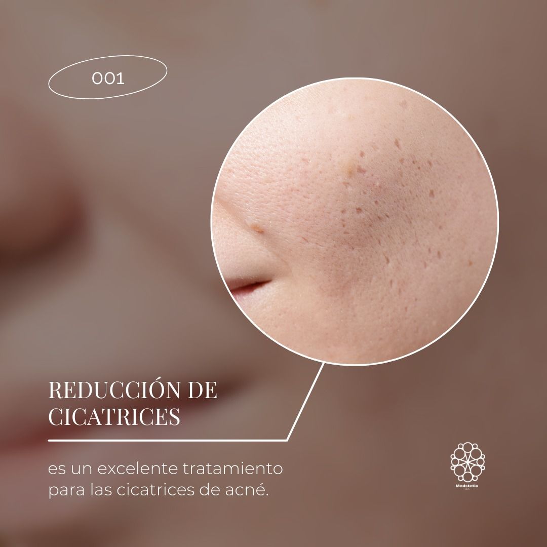 Nancy Jaqueline Radillo Morales-3