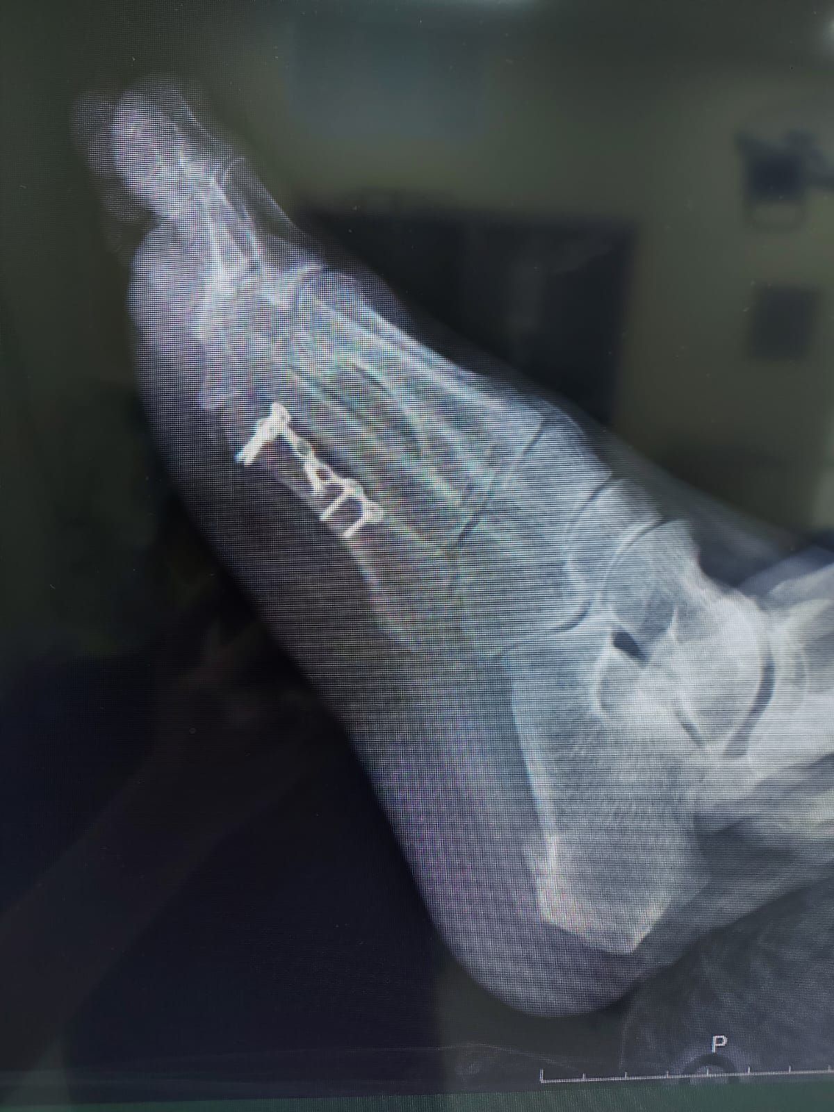 Zurit René Sánchez Vásquez-3