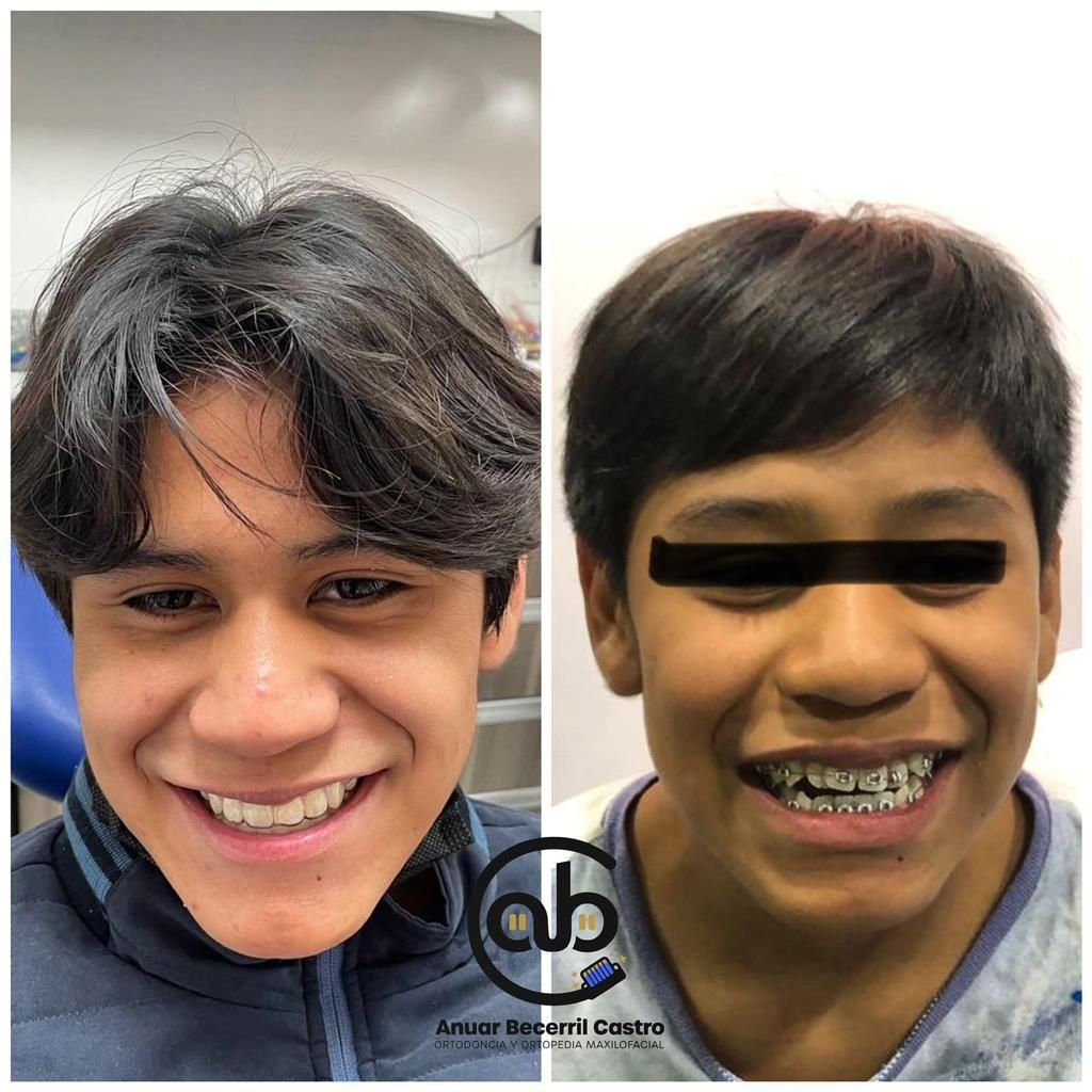 Anuar Becerril Castro-33