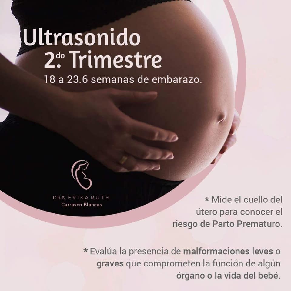 Leoncio Córdova Avelar-41