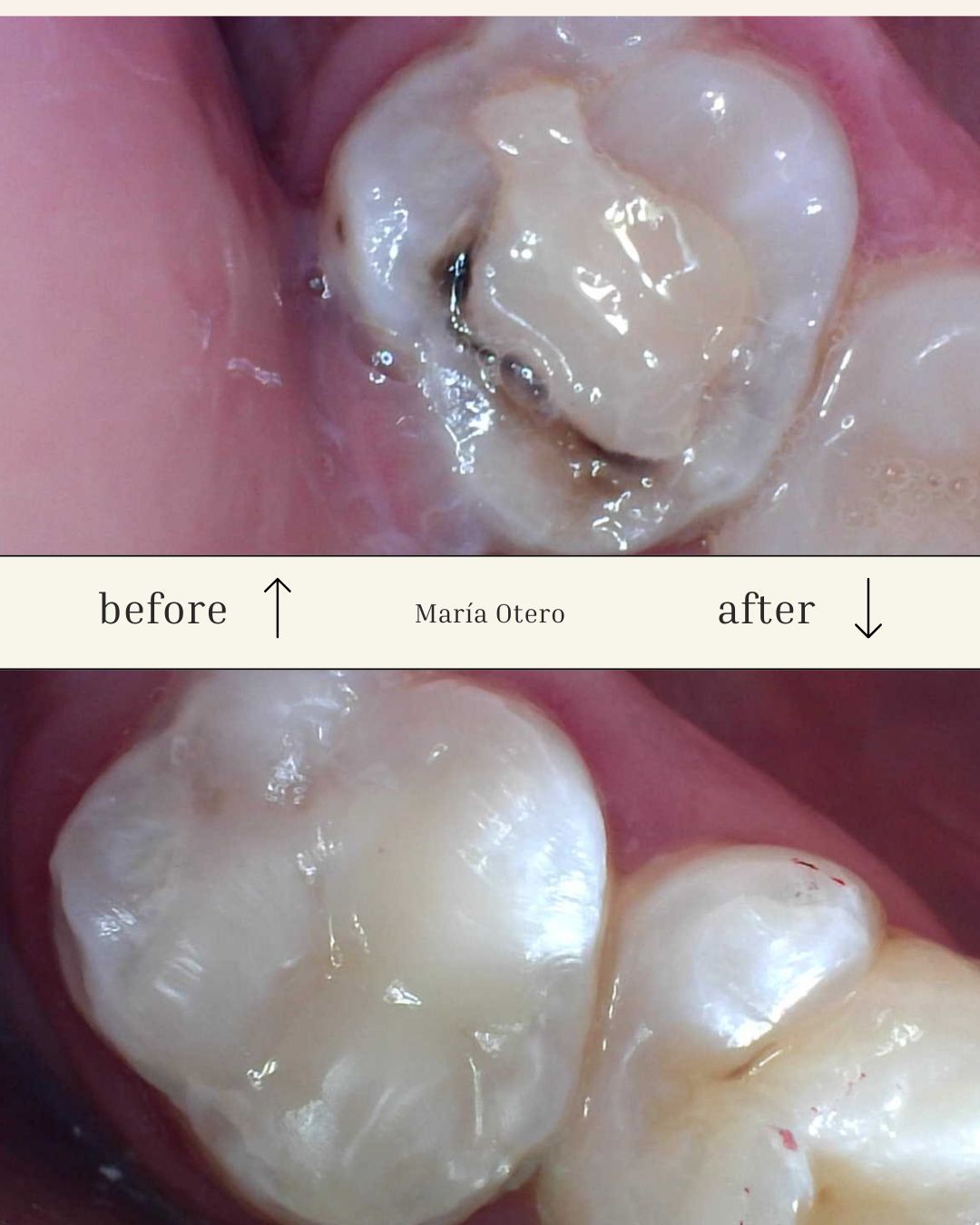 Maria Jesus Otero Lois-14