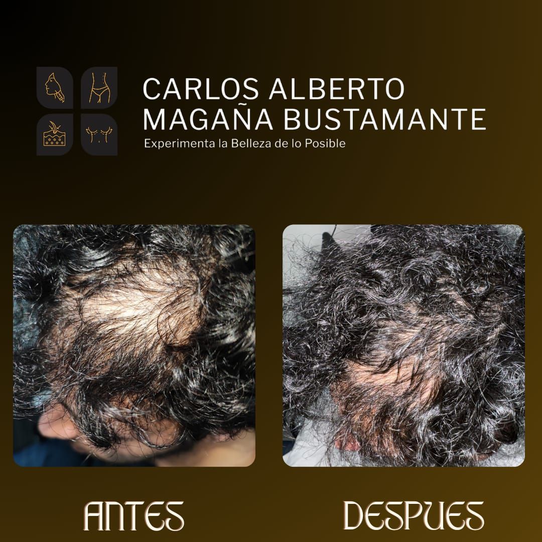 Carlos Alberto Magaña Bustamante-44