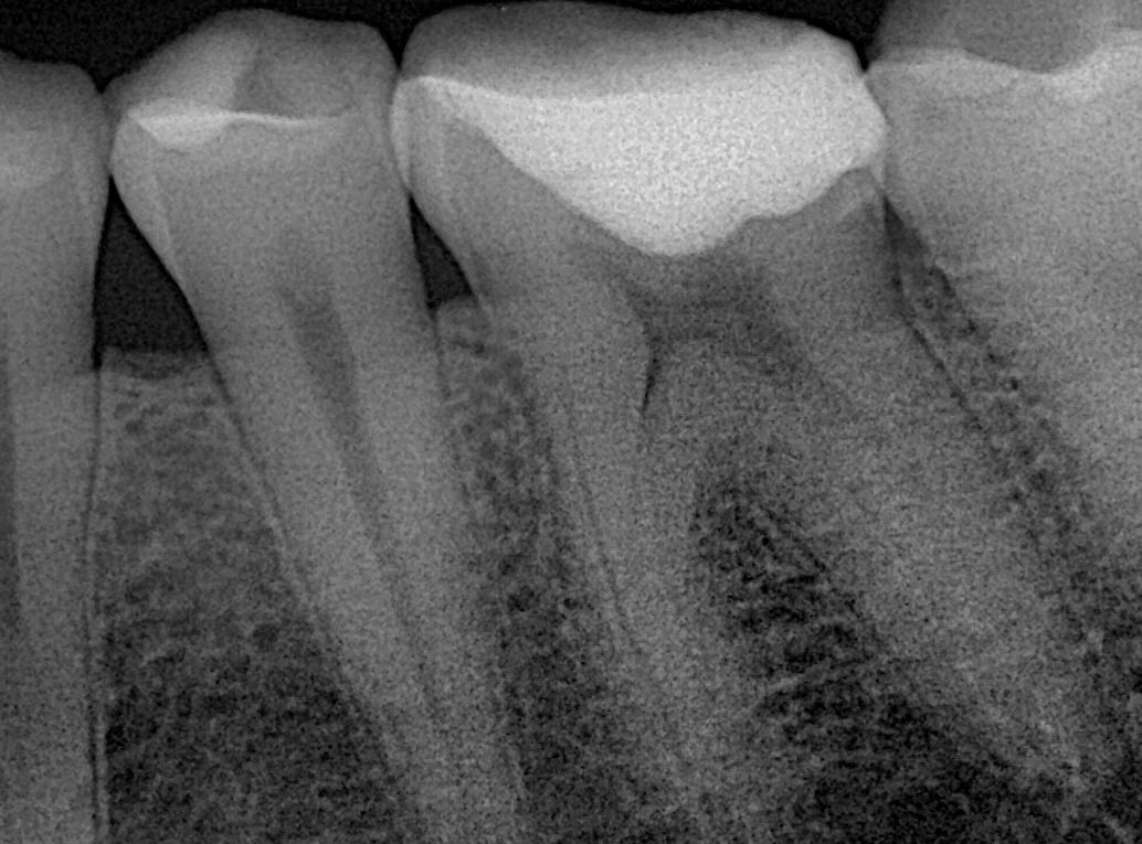Rocio De La Aurora Carreón Vázquez-16