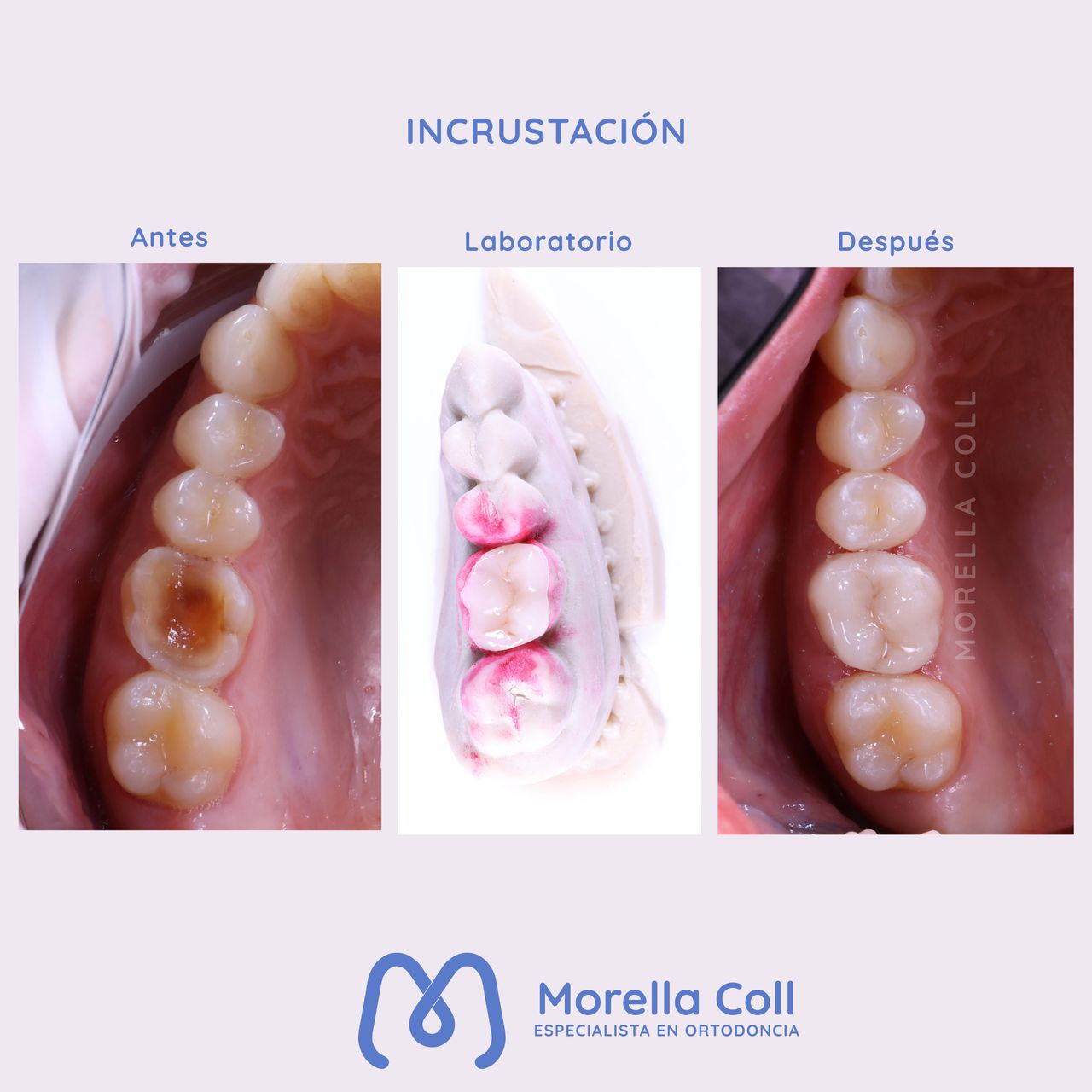 Morella Coll Mibelli-9