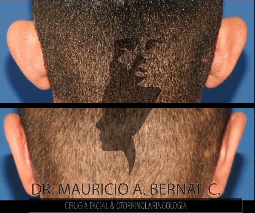 Mauricio Alejandro Bernal Carreon-9