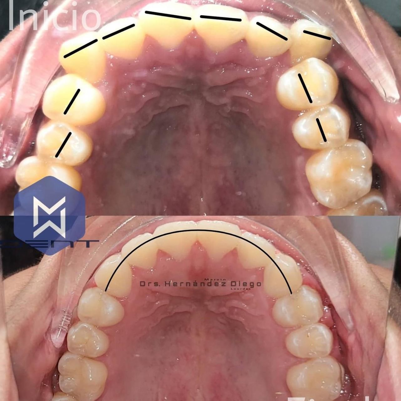Marvin Adair Hernández Álvarez-33