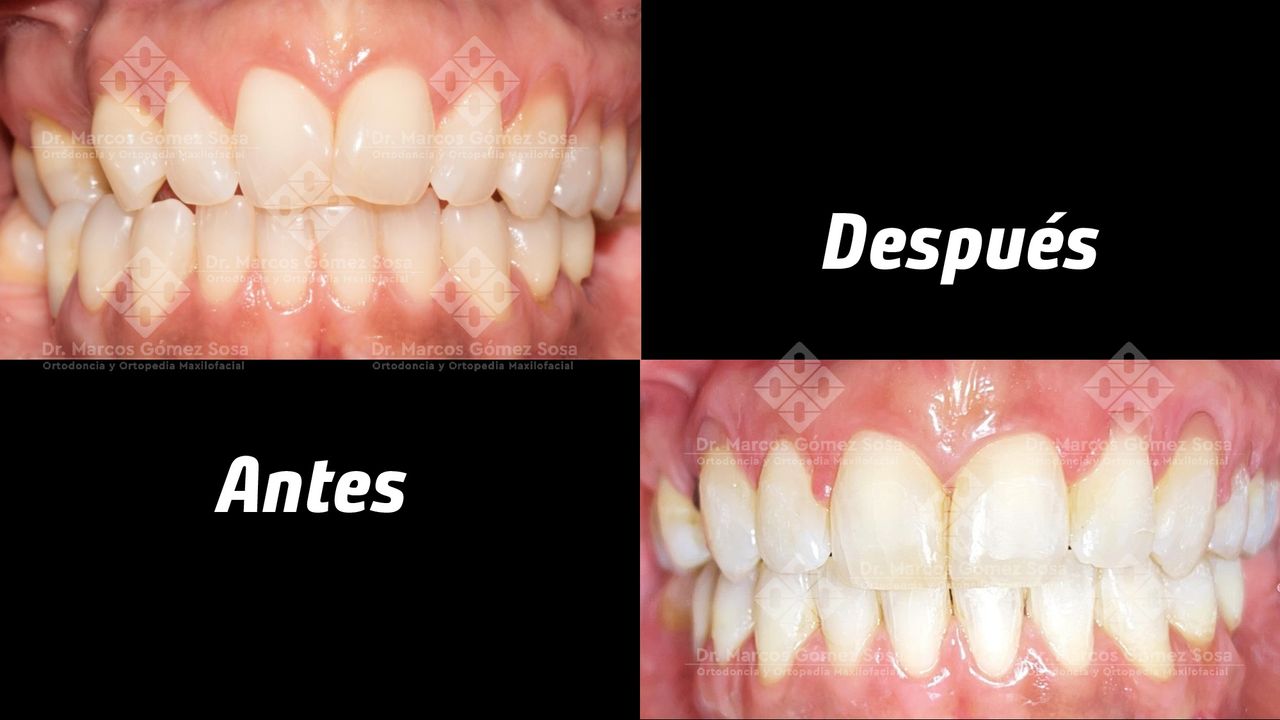 Marcos Gómez Sosa-8