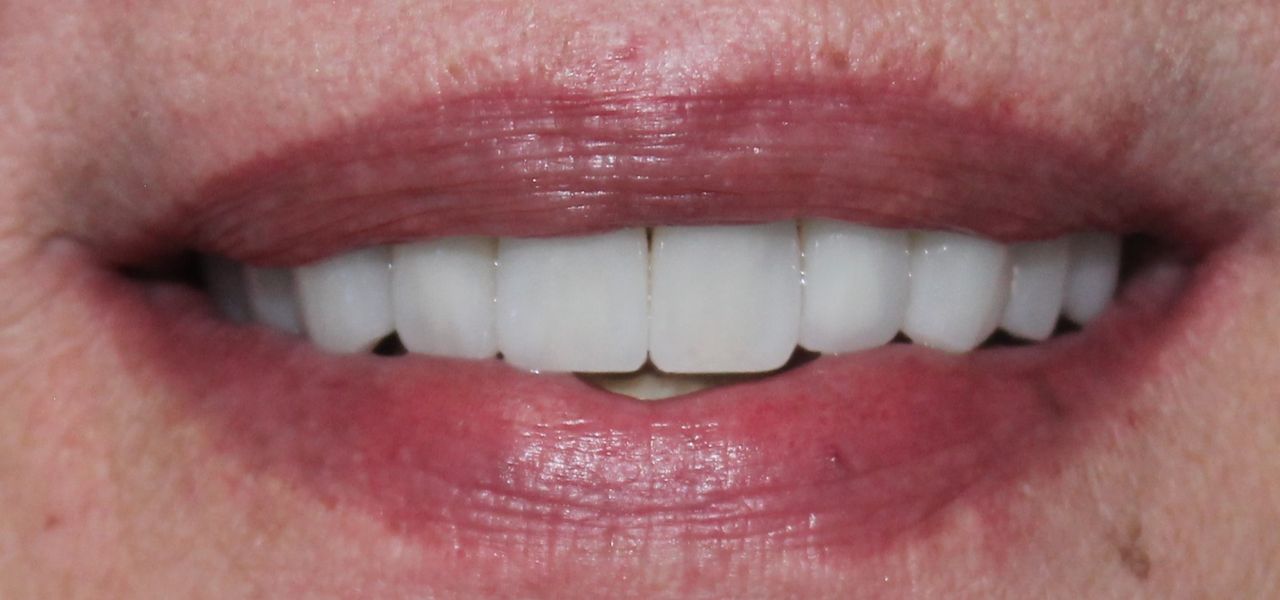 Aimee Valles Monárrez-48