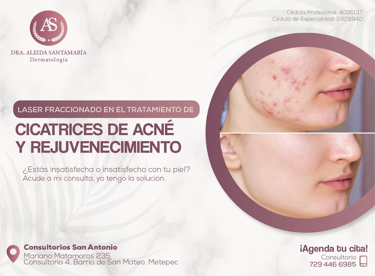 Aleida Santamaria Roman-4