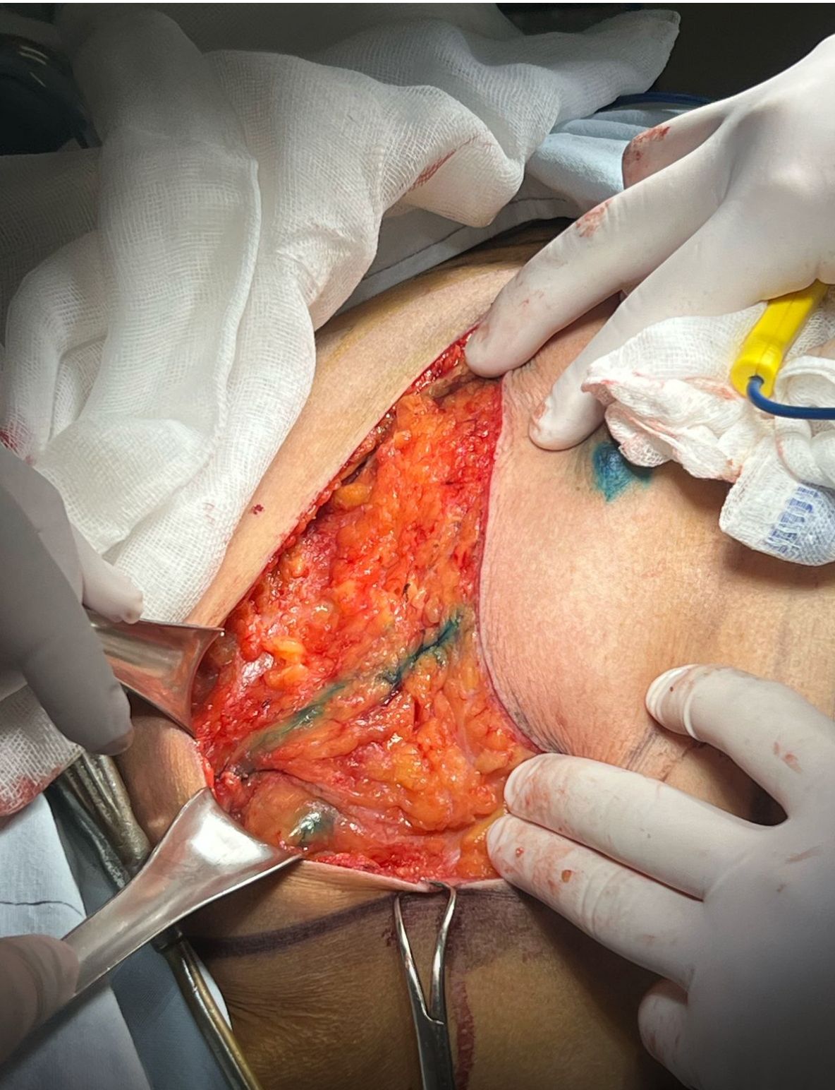 Christian Samuel Uitzil Colli-9