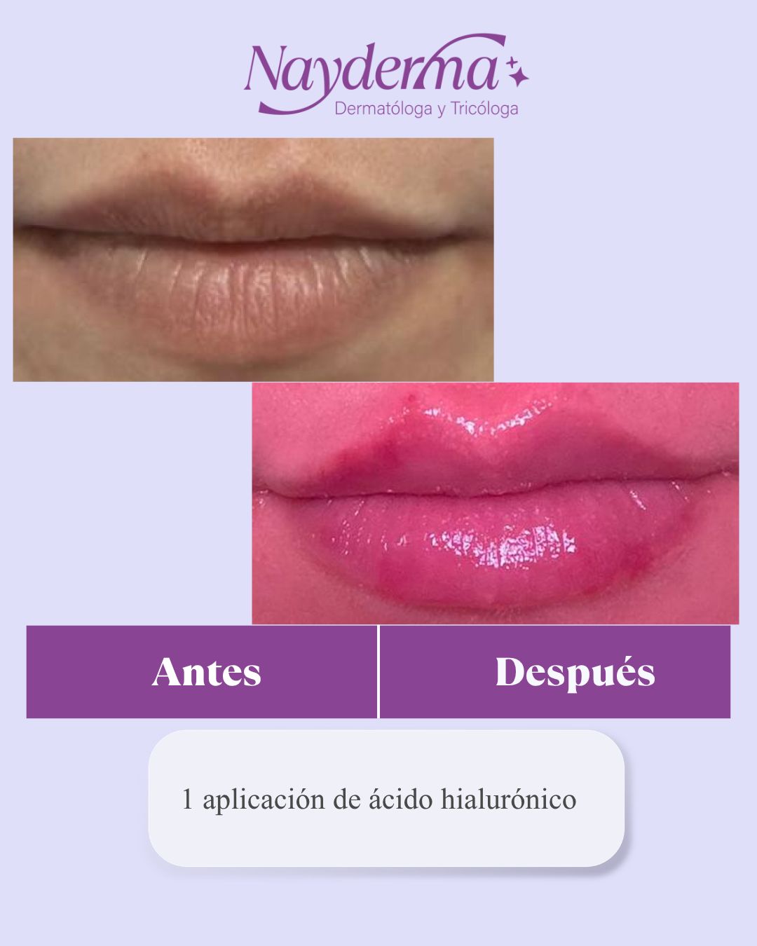 Nayra Aviña Padilla-18