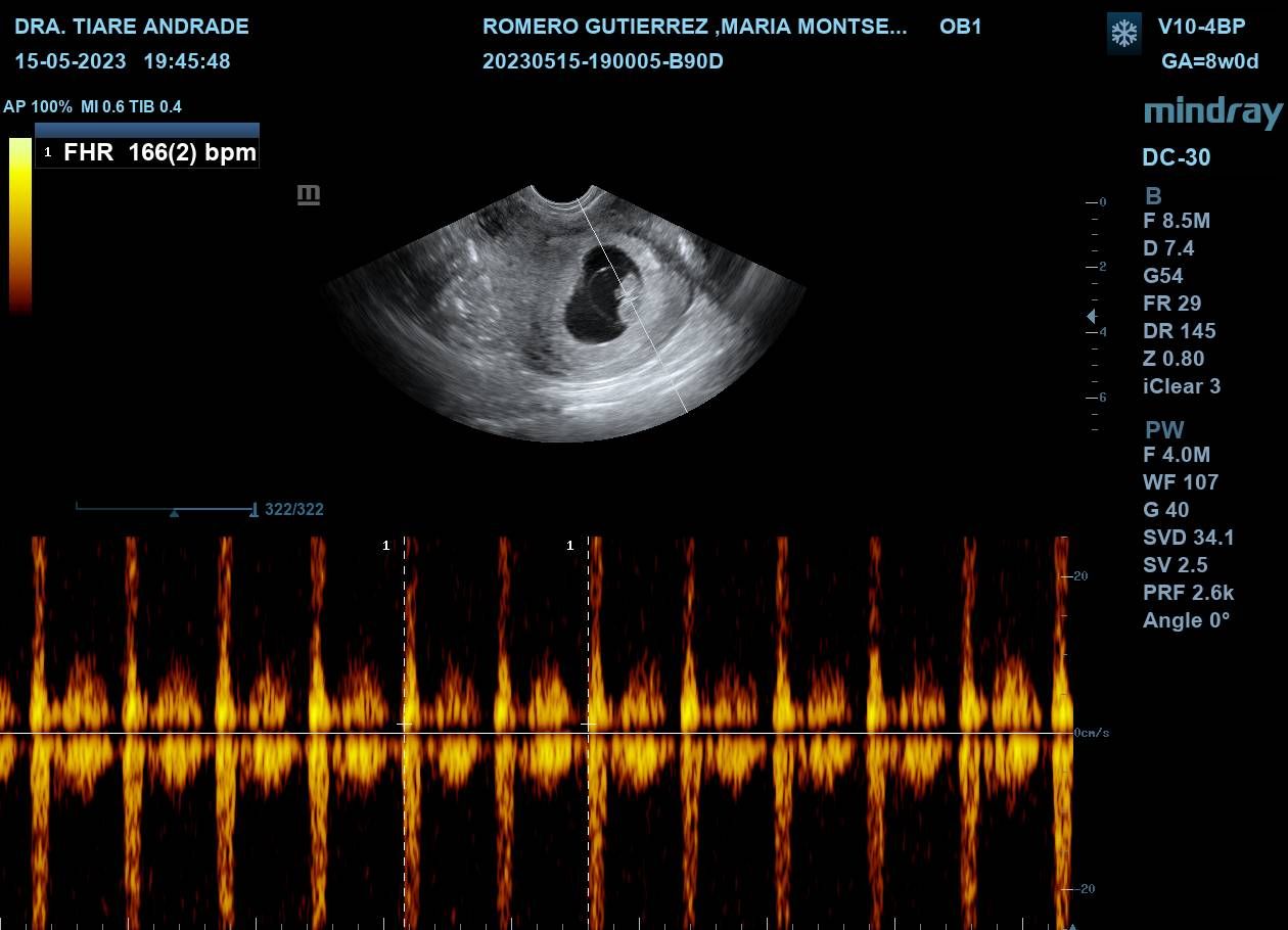 Tiare Andrade Urzua-4