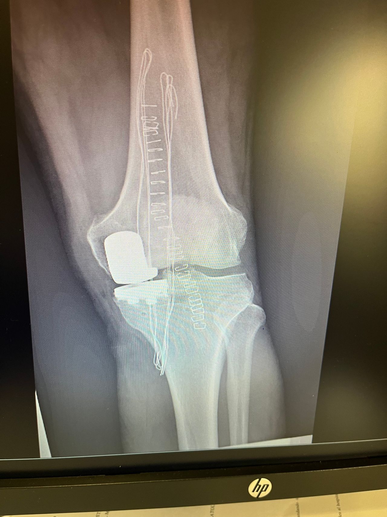 David Bernadac Giacomán-4