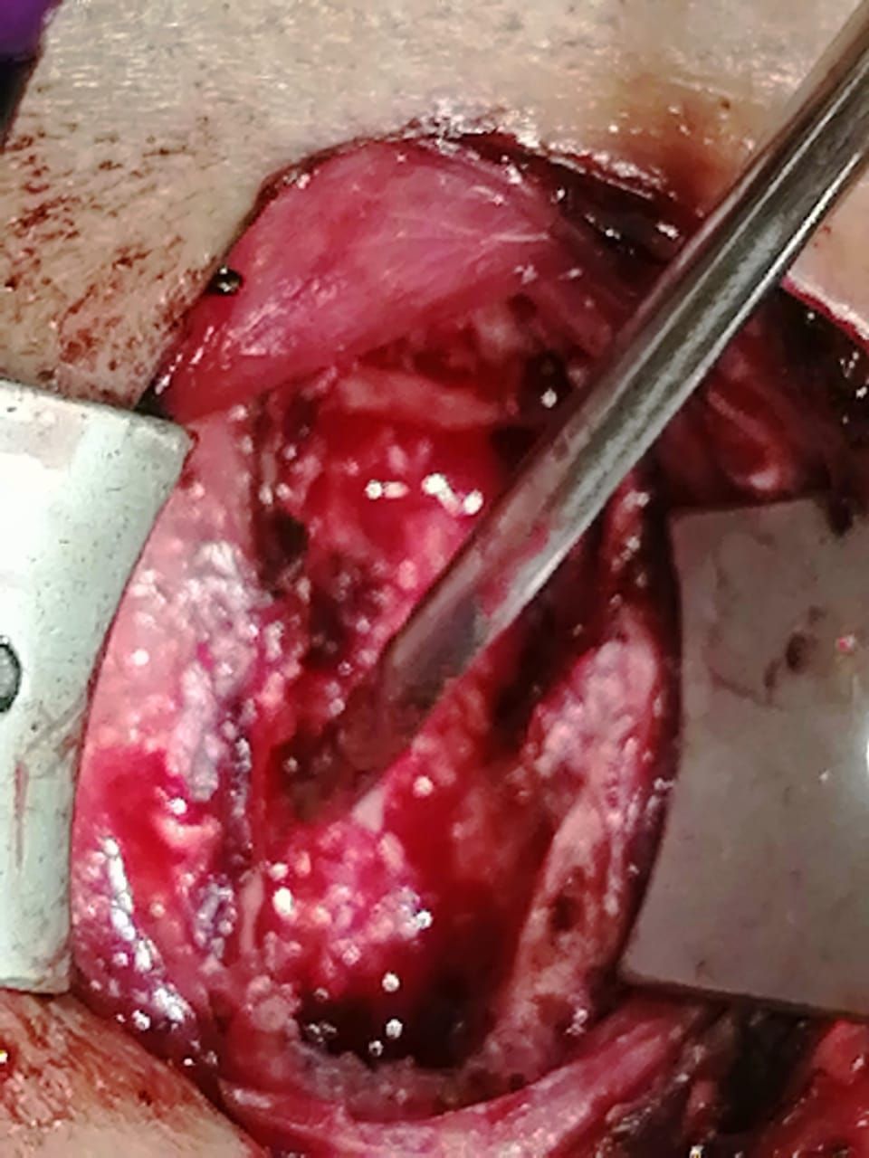 Juan José Luévano De La Cruz-35