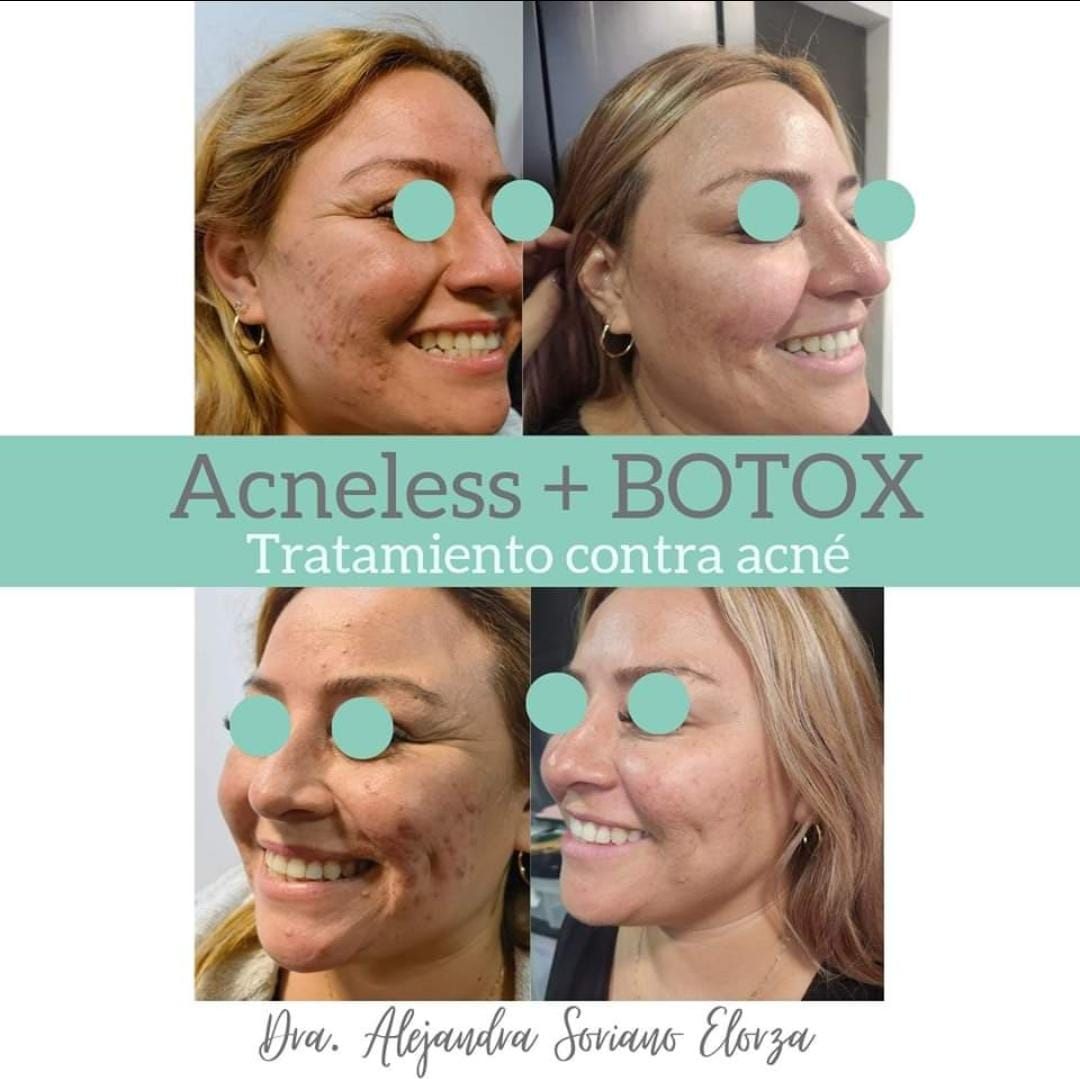 Alejandra Soriano Elorza-54