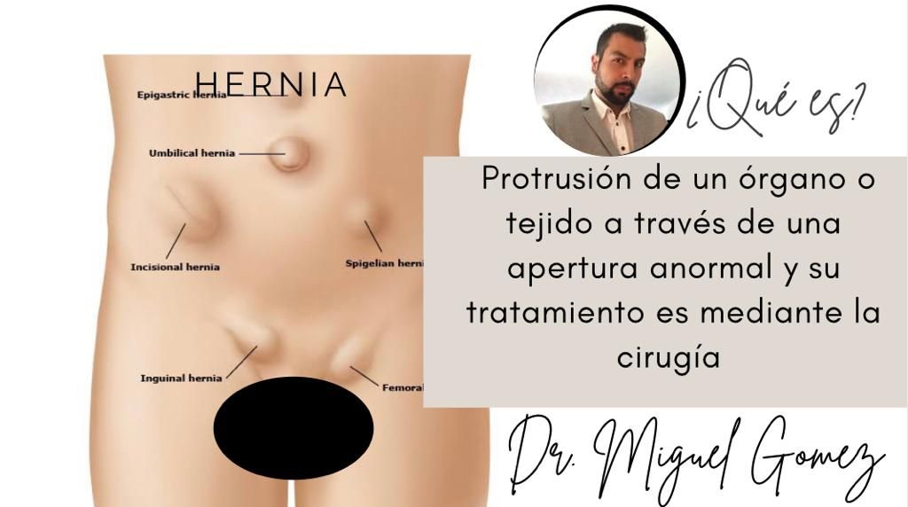 Miguel Ángel Gomez Estrada-5