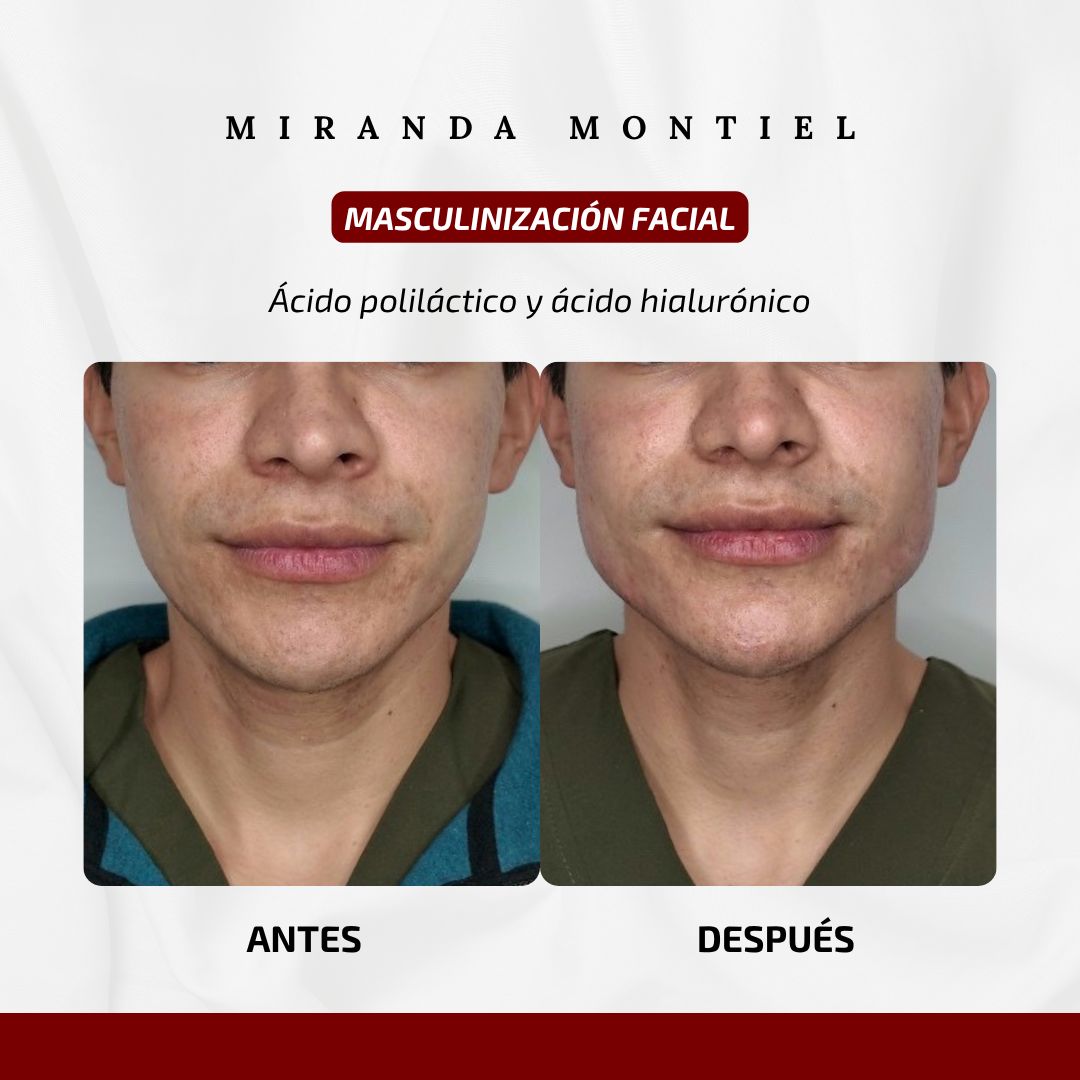 Carlos Guillermo Miranda Montiel-4