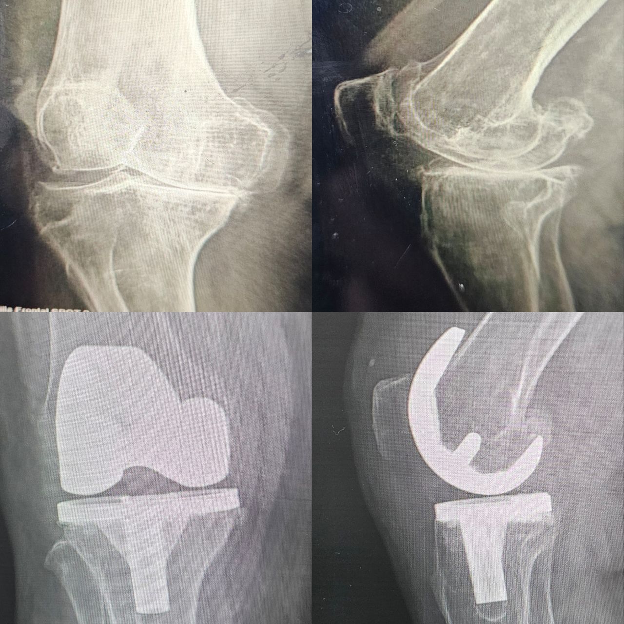 Elías Benjamín Preciado Tovar-0