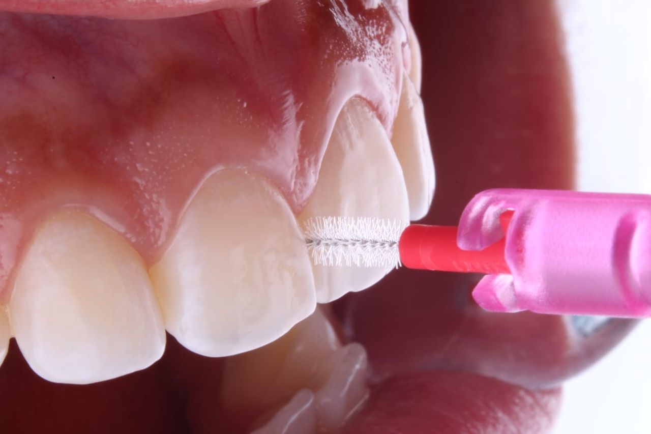 Hugo Enrique Aguilar Lamas-32