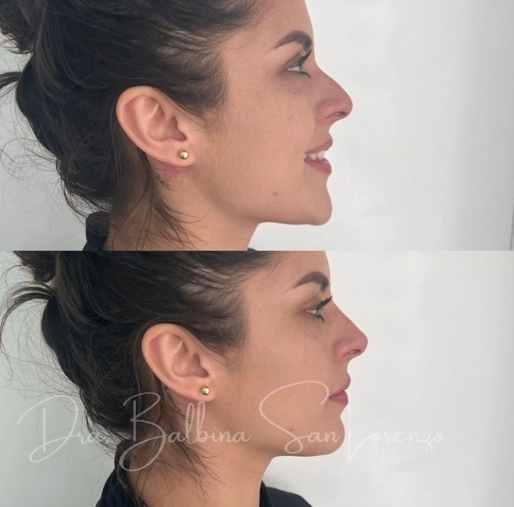 Balbina San Lorenzo Diaz-3