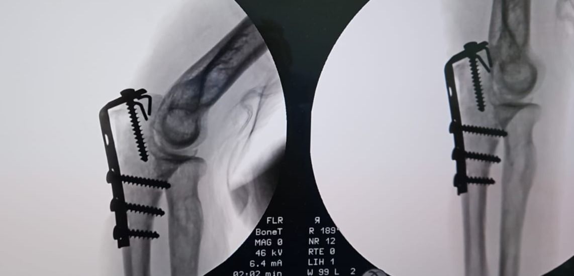 Leonardo Isaac Re-23