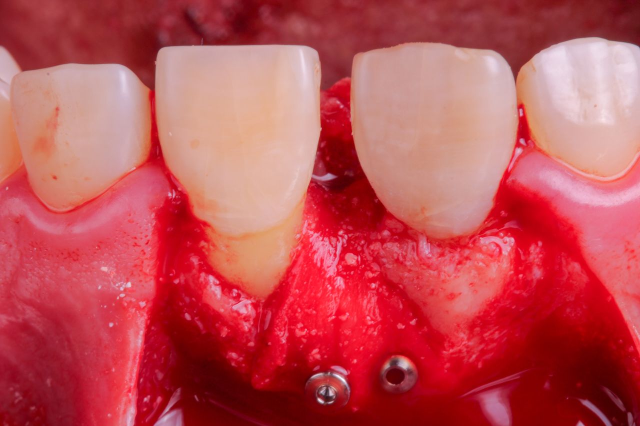 Hugo Enrique Aguilar Lamas-78