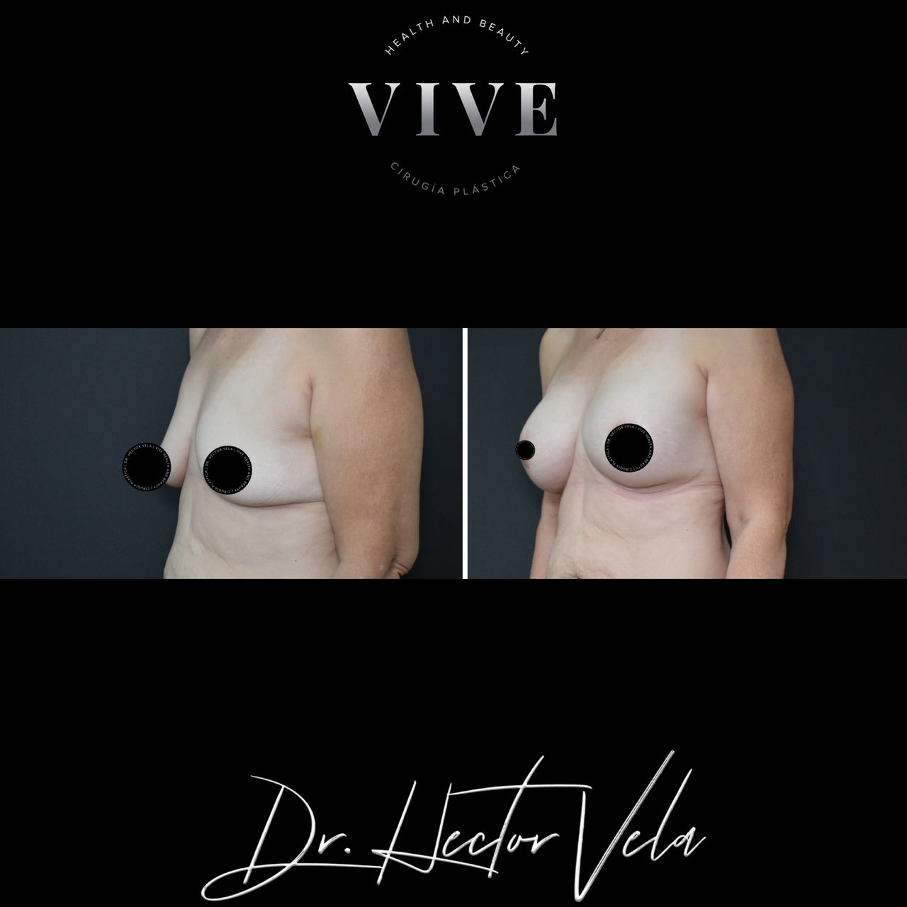 Héctor Eduardo Vela Cardona-115