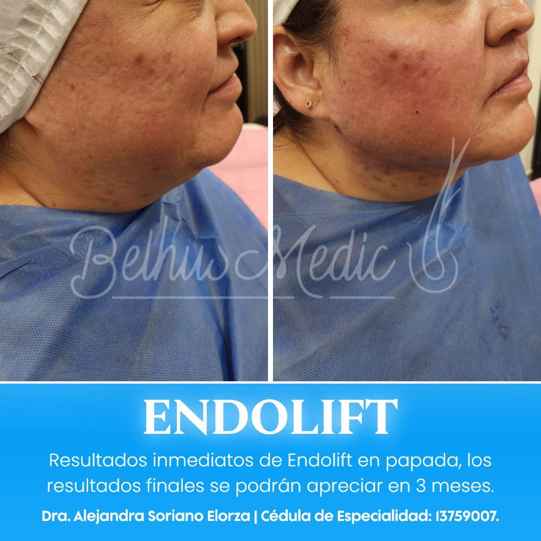 Alejandra Soriano Elorza-74