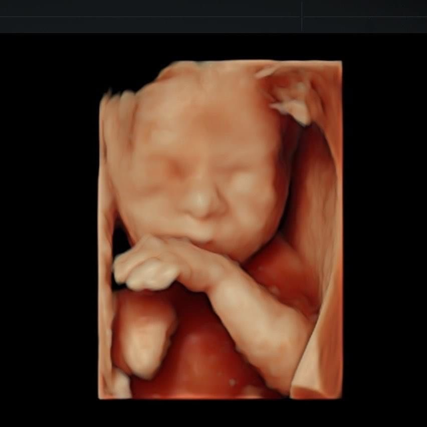 Omar Valderrama Loyola-6