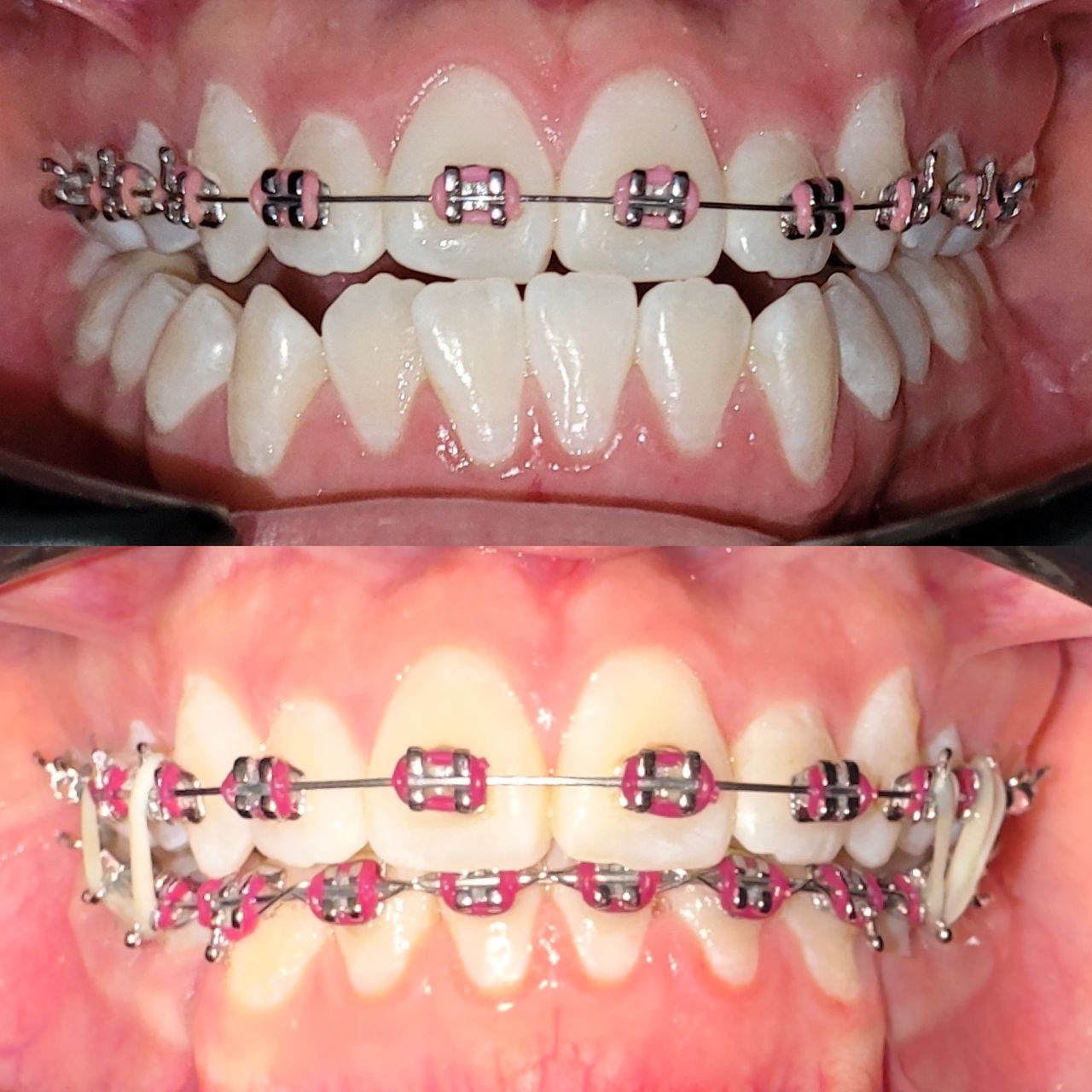 Marvin Adair Hernández Álvarez-18