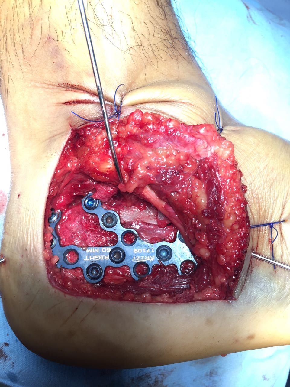 Carlos Alberto Romero Sosa-3