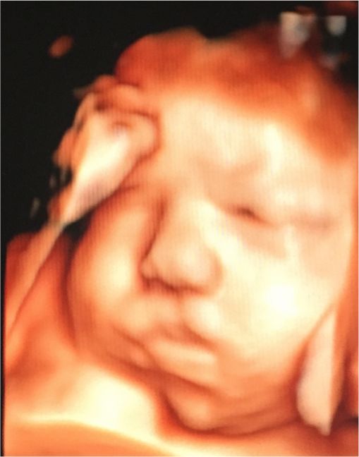 Susana Soto López-6