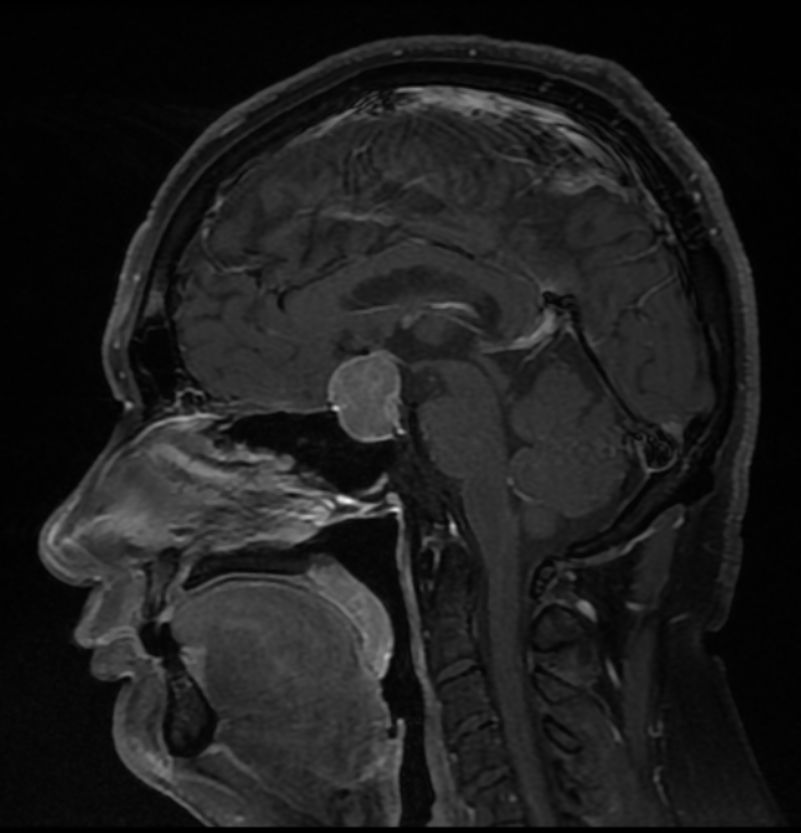 Gerson Reyes Rodríguez-38