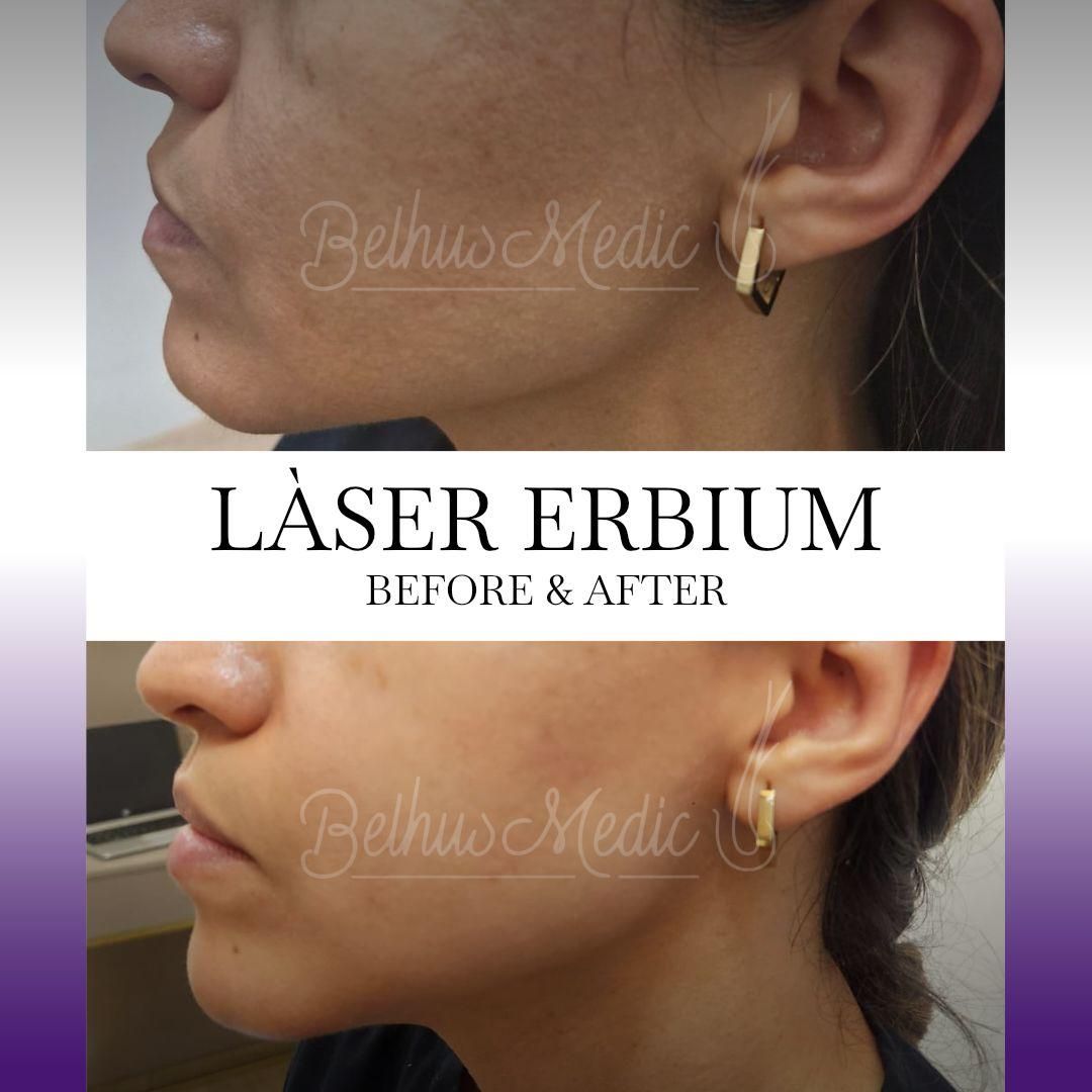 Alejandra Soriano Elorza-98