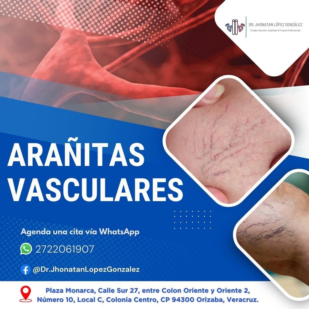 Jhonatan López González-85