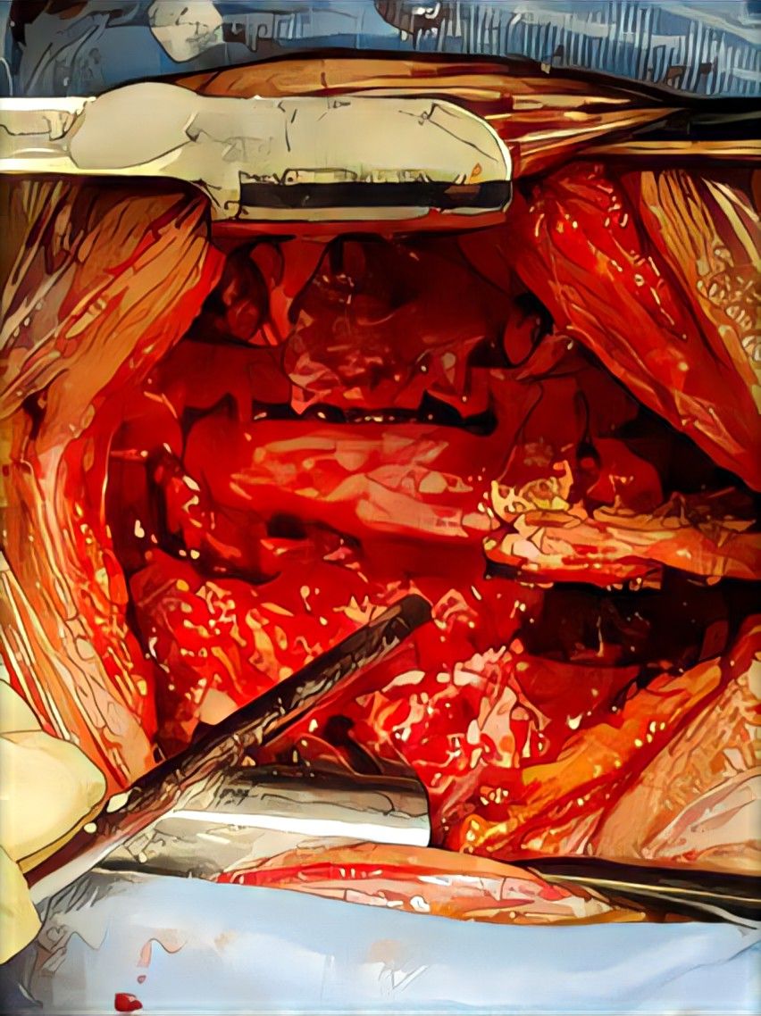 Gilraed Mota García-12