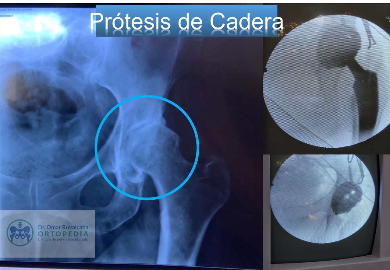 Omar Ruvalcaba Luna-23