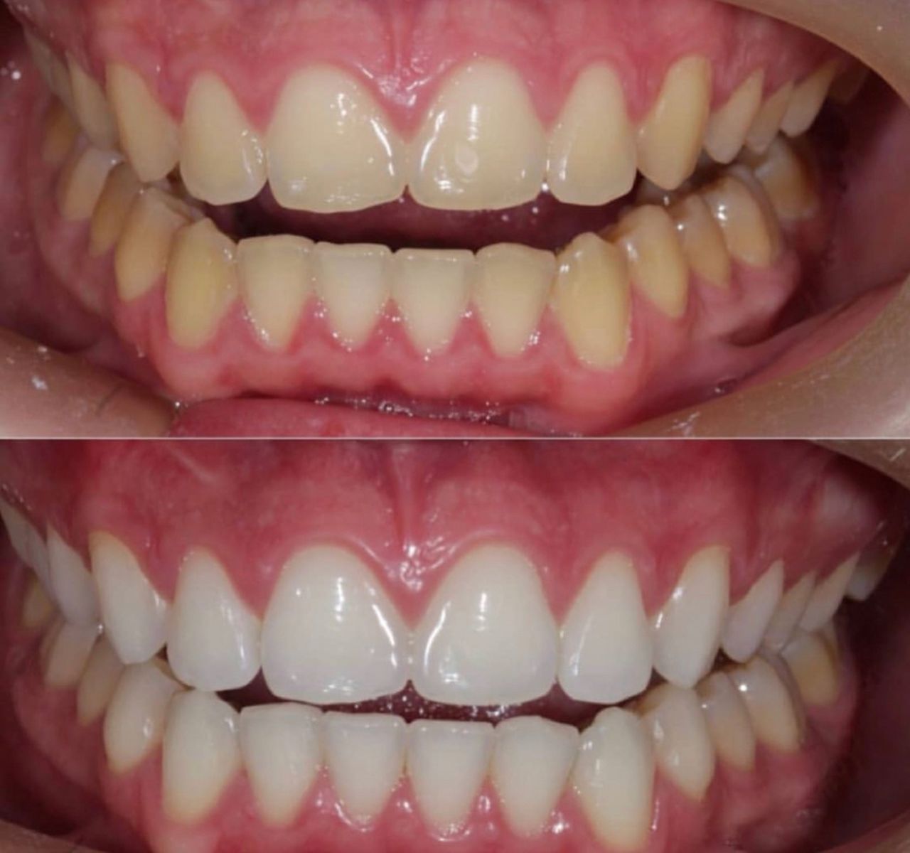 Ulises Alvarado Rodríguez-16