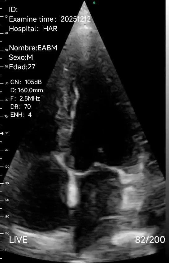 Carlos Enrique Blanco Méndez-6