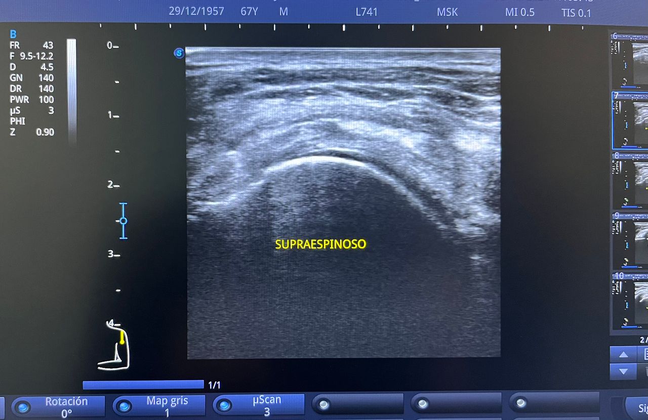 César Guerra Martínez-51