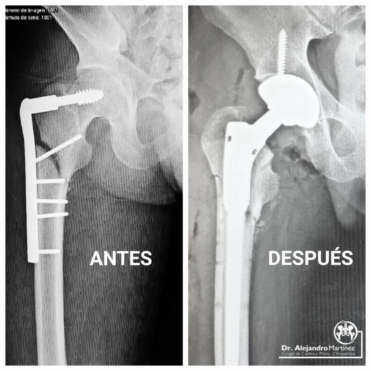 Alejandro Martínez Ramírez-4