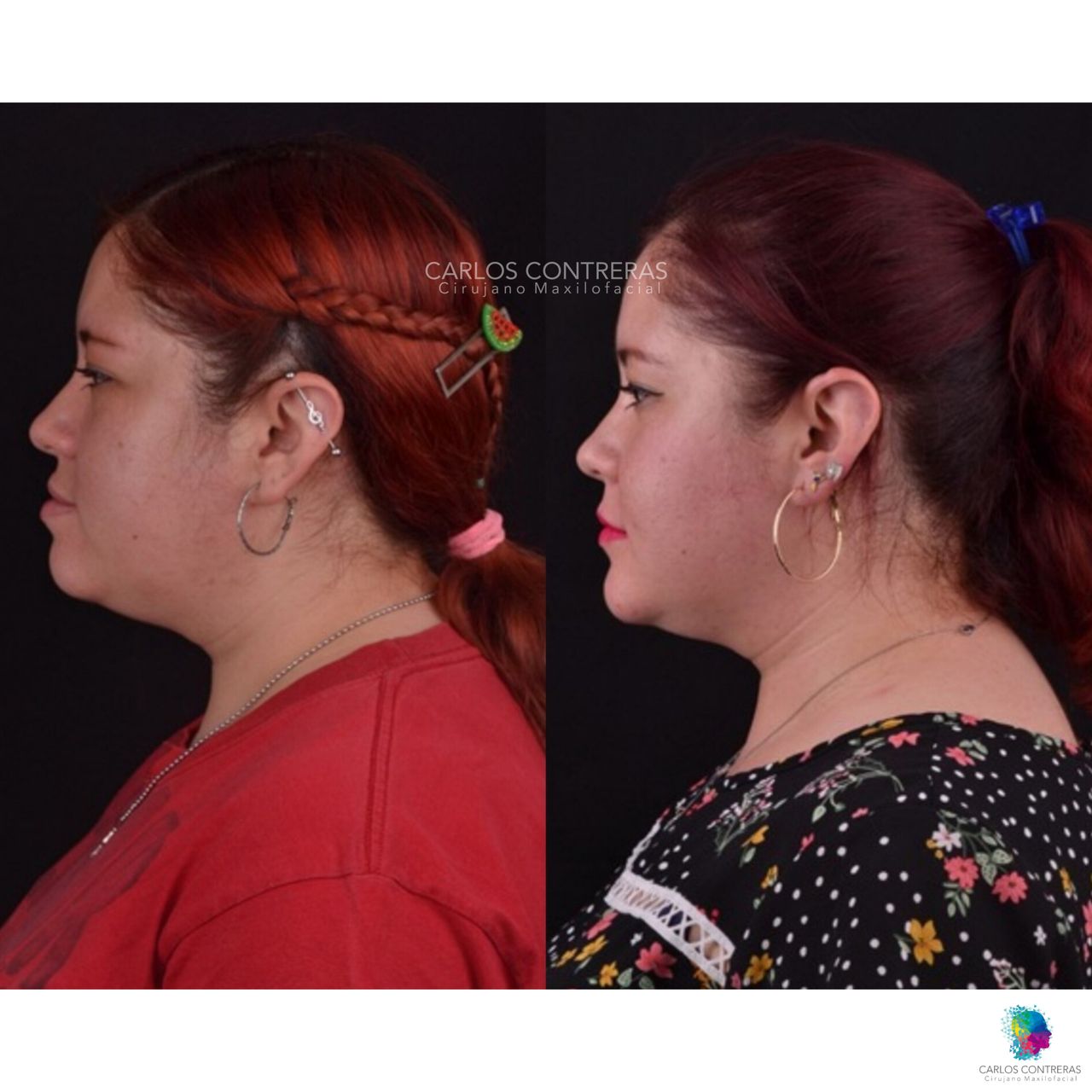 Carlos Ernesto Contreras Castellanos-0