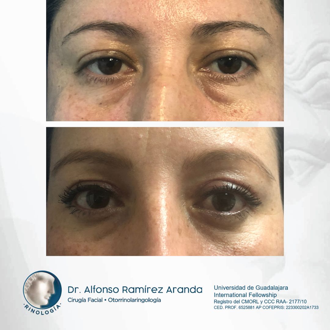 Alfonso Ramírez Aranda-5