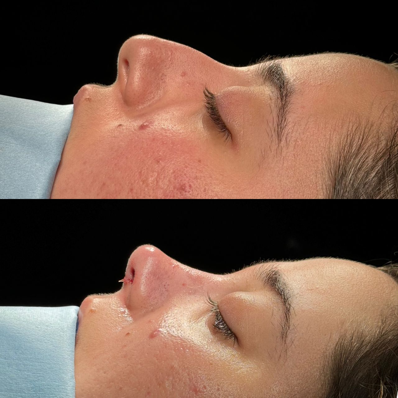 Angel Castro Urquizo-120